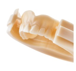 AuDental | Multilayer PMMA Dental Milling Disc – Natural Gradient Temporaries
